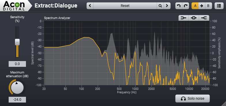 The Extract:Dialogue User Interface